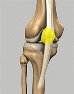 Patella